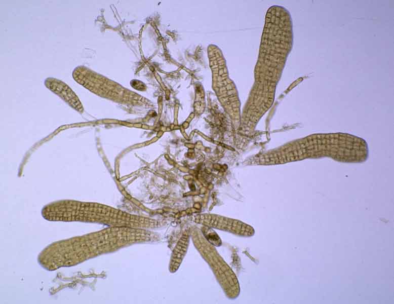 Early sporophytes of Alaria esculenta growing on female filamentous gametophyte.
