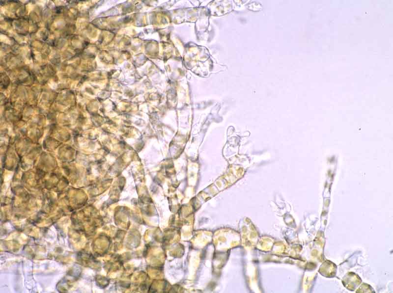 Male filamentous gametophyte.