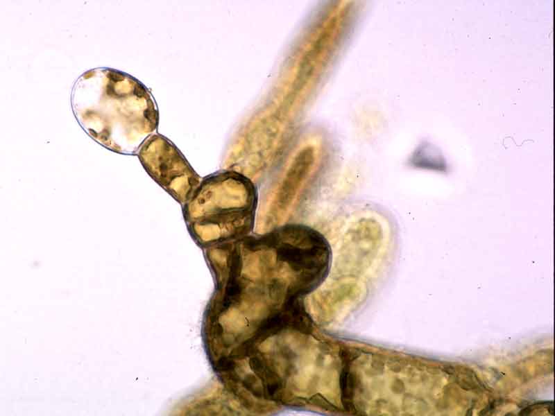 Oogonium (egg) on female gametophyte.