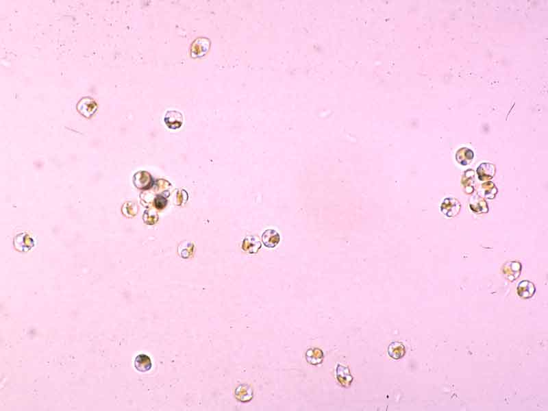 Alaria esculenta zoospores.